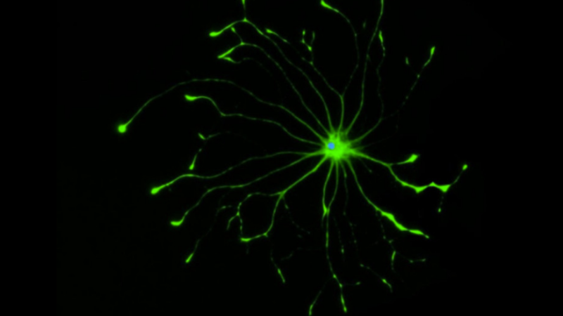 Why some brain cells go ‘bad’